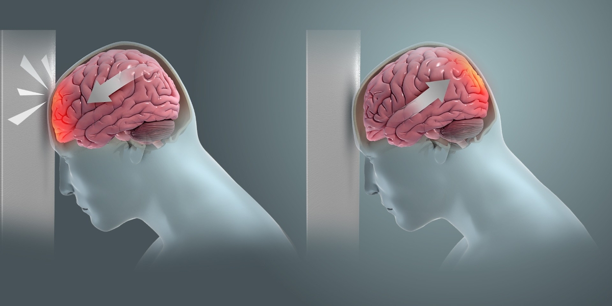 British researchers: New football design can reduce heading impact and injuries